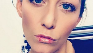 Agáta ukázala zakrvavené pery. Čo sa jej STALO?!