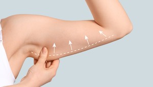 Trápia vás ovisnuté svaly na rukách? Vyformujte si paže aj ramená iba za 4 minúty