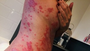 Máte "zahanbujúce "ochorenie? Psychologička vám poradí, ako o ňom hovoriť.