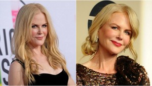 Po rokoch sa ukázala bez PAROCHNE: Vážne má Nicole Kidman toto na hlave?