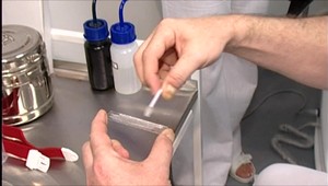 Máte na rukách krv, odkazuje odporcom očkovania minister zdravotníctva