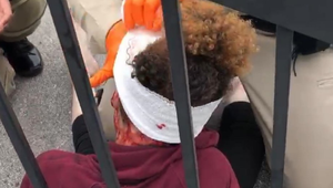 Peklo v USA sa stupňuje! Dobodali neter Michaela Jacksona!