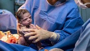 Jej zamračená tvárička ihneď po narodení obletela svet: Pozrite sa, ako dievčatko vyzerá dnes!