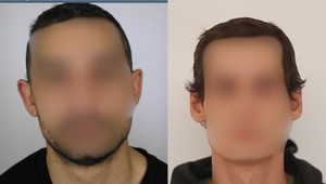 Z liečebne v Sučanoch utiekli dvaja muži, jeden je nebezpečný. Polícia ich vypátrala