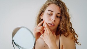 Najlepší spôsob, ako sa zbaviť nepríjemnej vyrážky: Dermatologička vám ukáže, ako na to!