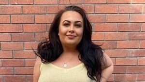 Trápila ju nadváha aj silné akné: Jej extrémna premena dnes motivuje ženy z celého sveta