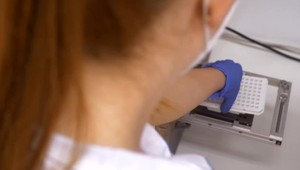 Testovať sa chodí takmer každý, ale ako už diagnostikujú stery PCR metódou vidia iba odborníci