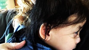 Svet šokovali jej strieborné oči: Ako dopadlo výnimočné dievčatko?