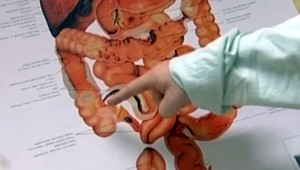 Nová štúdia: zloženie črevného mikrobiómu môže mať vplyv na vznik cievnej mozgovej príhody!