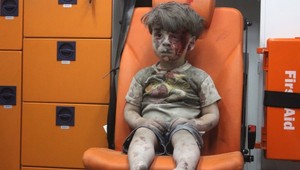 Chlapec zo sanitky sa stal symbolom utrpenia v Sýrii