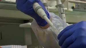 Česko získalo ďalší liek na COVID-19, podali ho už prvej pacientke