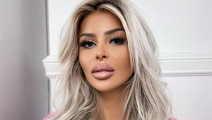 Lela Ceterová pred svadbou poriadne prekvapila: Na klinike si dala vymodelovať novú tvár!