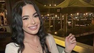 Zväčšenie pier sa zmenilo na nočnú moru: Keď sa uvidela po zákroku v zrkadle, čakal ju ŠOK