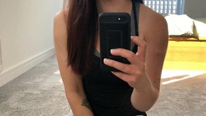 Keď doktorka uvidela jej tvár, skoro odpadla: Je TOTO žena s najhorším akné?