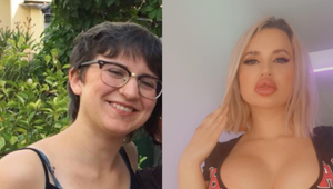 Z priemerného dievčaťa sa zmenila na silikónovú umelinu: Fotky pred a po