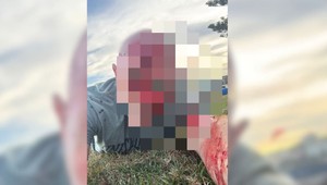 Prežil útok Hamasu, teraz zažil kviprelievanie na pláži v Austrálii. Právnik opísal chvíle hrôzy