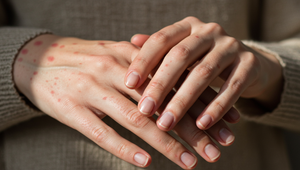 Mladá žena (†24) zomrela pár dní po dovolenke. Lekári hovorili o alergii, dvakrát ju poslali domov