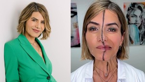 Takto to funguje: Šialené, čo dokáže botox so ženskou tvárou urobiť