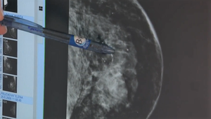 Pre Covid-19 idú ďalšie choroby bokom, pacientom sa už mesiace nedarí dostať na svoje vyšetrenia