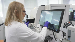 Presnejšie a rýchlejšie. Vzorky v nemocnici vyhodnocuje inteligentná linka