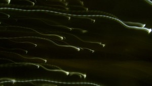 Prevratný pokus: Vedci použili ľudské kožné bunky a vytvorili funkčné vajíčka