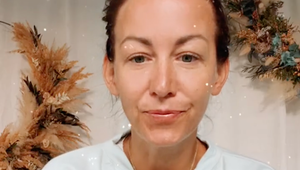 Botoxová kráľovná od 27 rokov! Agáta väčšie úpravy nepodstúpila, v pláne je ale TENTO zákrok!