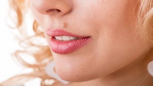 Pozor na signály kože. Po lete nám na koži mohli pribudnúť znamienka či škvrny