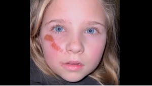 Detská ukrajinská modelka žiada Putina: Prosím, zastavte svoje vojská!