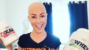 Zo svojho hendikepu urobila prednosť. Dnes je z tejto ženy žiadaná modelka