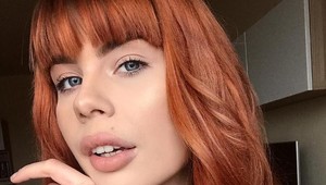 Slovenská vlogerka sa zbavila silného akné: Prezradila, ktoré sérum jej naozaj pomohlo