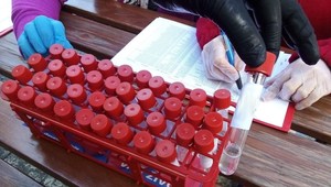 Od dnes sa môžete po novom otestovať na koronavírus. Zistite, či ste vírus prekonali