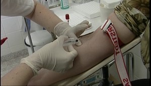 Vírus HIV ohrozuje všetkých! Takto sa treba chrániť