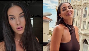 Soňa Skoncová otvorene o prirodzenosti a sebaláske: Botox odmieta, nefarbí si ani vlasy!