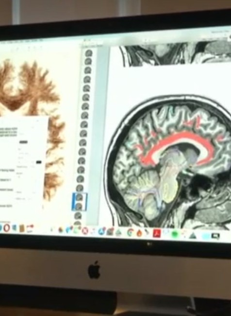 Vedci zistili: Leonardo da Vinci by bol pravdepodobne diagnostikovaný ADHD