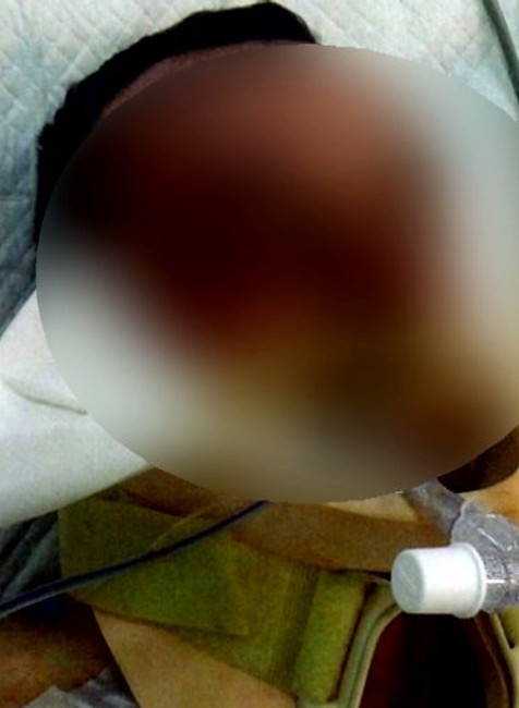 Polícia identifikovala zraneného cyklistu