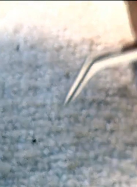 Pri akej teplote už v lese nestretnete kliešťa? Odborník radí