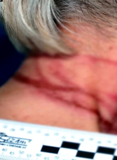 [multi] POkus o vraždu 6140