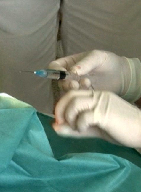 Liek z Kuby v podozrení. Diabetickú nohu lieči, ale môže spôsobiť ďaleko väčšie problémy