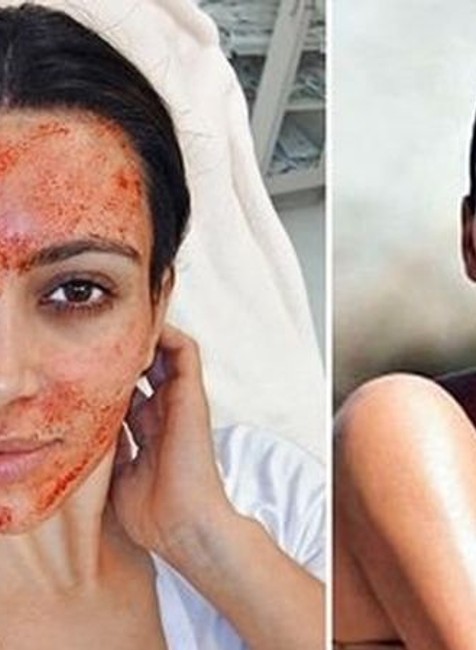 Kardashianky a ich rodina Kim Kardashian - plastiky 1