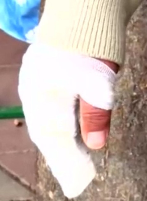 Prechádzka s vnukom sa zmenila na drámu: Muža napadli psy