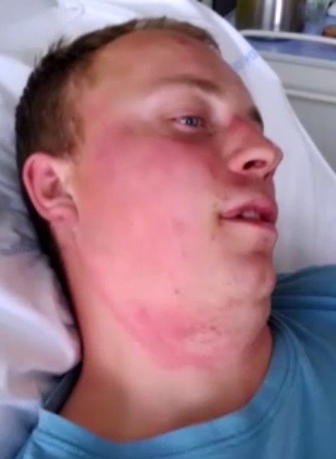 Pre kolíziu dvoch traktorov skončil mladý muž v nemocnici. Dobiť ho mal druhý šofér