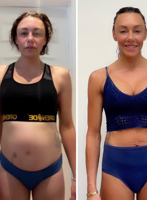 Michelle Heaton naľavo v prvý deň liečby a vpravo 9 mesiacov bez alkoholu