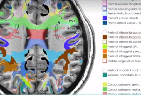 Vedci zistili: Leonardo da Vinci by bol pravdepodobne diagnostikovaný ADHD