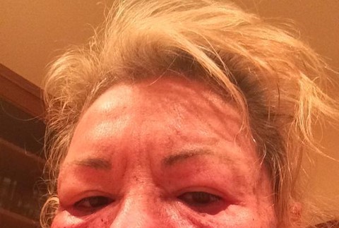 Roseanne Barr