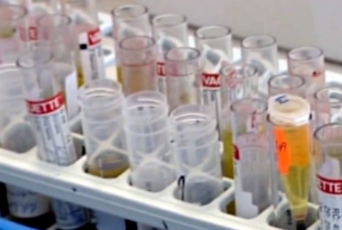 Nová štúdia dokázala nedokonalosti v antidopingovom systéme