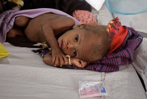 Afrika-sever_hladomor_foto