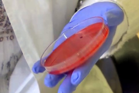 Pacienti si počkajú na diagnostiku. Nemocnice rušia niektoré oddelenia