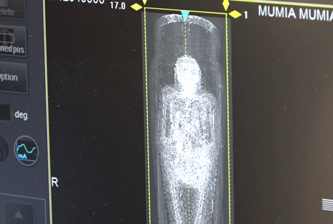 CT múmie 3