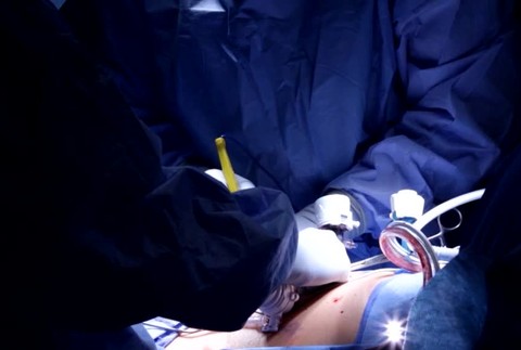 [multi] Transplantácia HIV 789