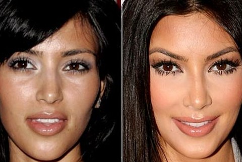 Kardashianky a ich rodina Kim Kardashian - plastiky 2